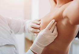 Risarcimento di 100mila euro per ritardo diagnosi di un tumore della mammella