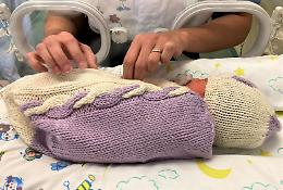 Prematuri, 'Mani di mamma' veste di viola i bimbi ricoverati in Patologia neonatale
