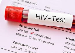Infettò l'ignara compagna con l'Hiv, la motivazione della sentenza: «Non manifestò mai pentimento»