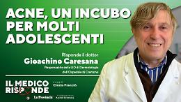 Acne, primo cruccio dei giovanissimi: ma i rimedi ci sono