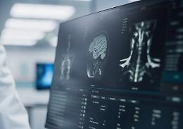 L'intelligenza artificiale legge la risonanza in 10 secondi