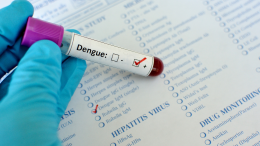 Caso di Dengue.  ‘Zona rossa’ bonificata 