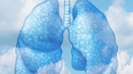 Aria pi&ugrave; pulita in Lombardia nel 2025, ma Soresina resta sotto osservazione