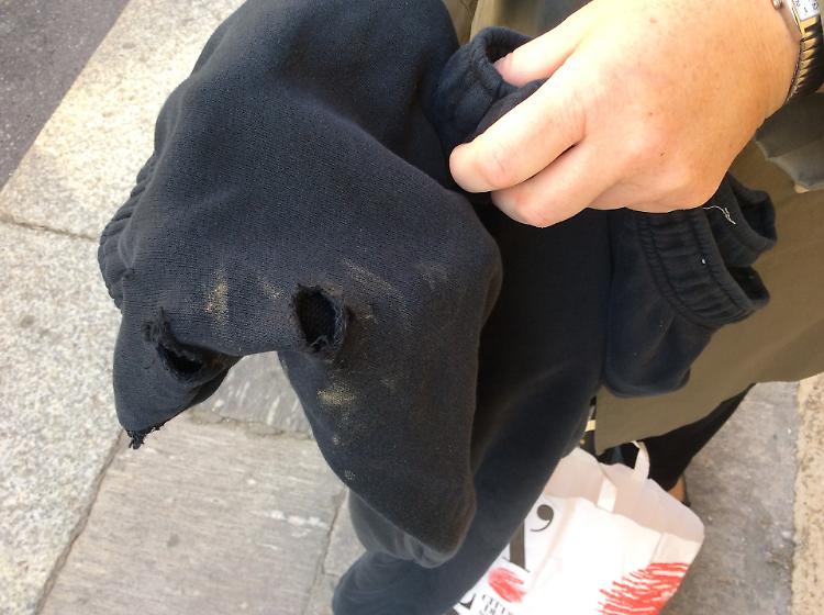 Musicista 18enne aggredito da due 'mastini indemoniati'