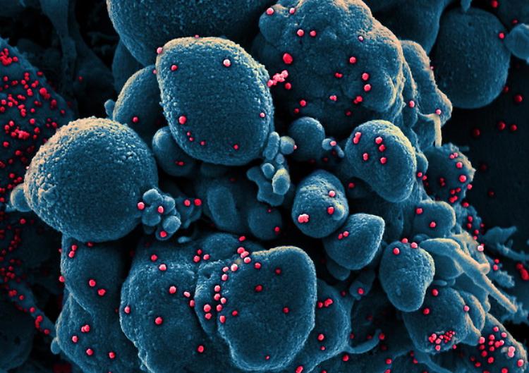 Virus, più di 195.000 i morti nel mondo