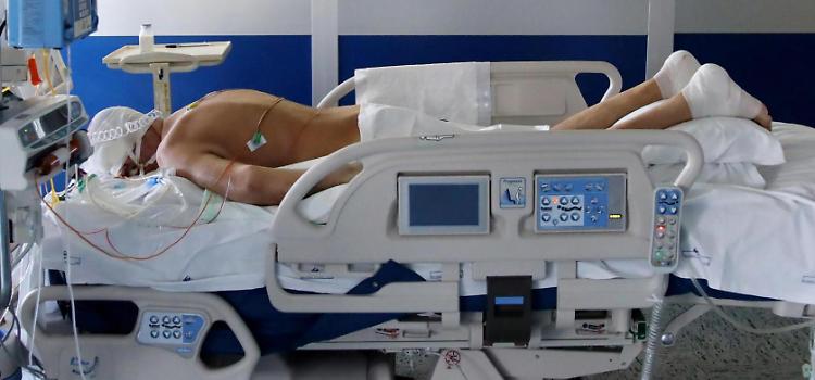 Covid, ecco come il virus condiziona la vita del 36% degli ex pazienti