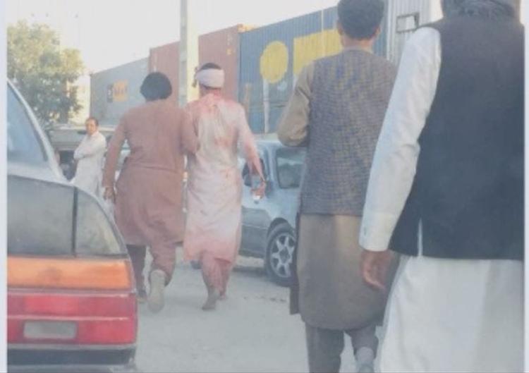Afghanistan,  attacco suicida all'aeroporto: 13 morti, feriti marines e Gb